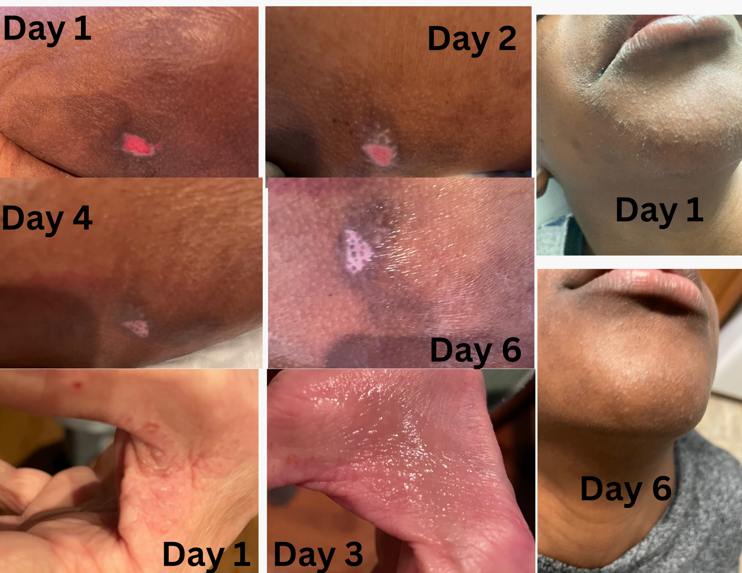 Wound & Skin Salve
